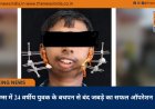 सिम्स में 24 वर्षीय युवक के बचपन से बंद जबड़े का सफल ऑपरेशन